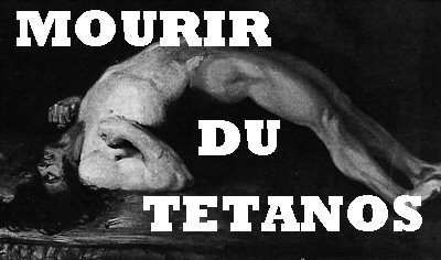 http://a137.idata.over-blog.com/0/08/39/13/divers-et-avaries/mourir-du-tetanos-referencement-google.jpg